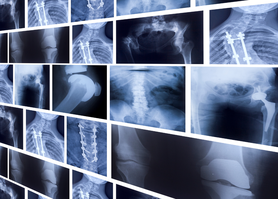 Digital X-Ray Services